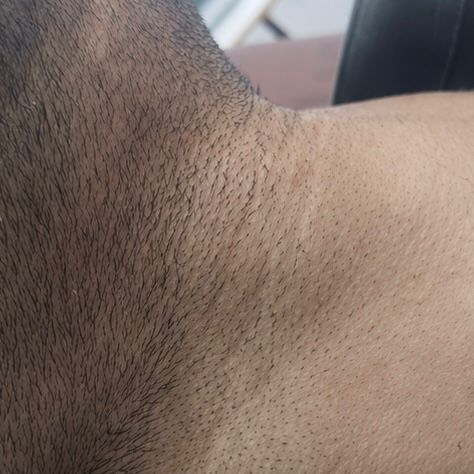 Before Beard / Hair Line Care