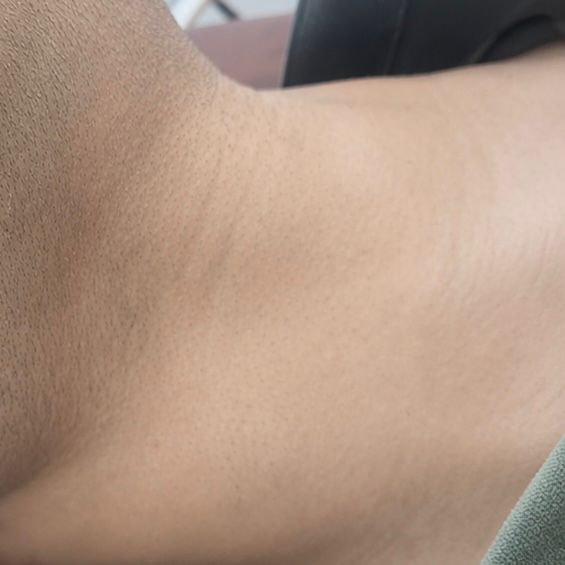 After Beard / Hair Line Care